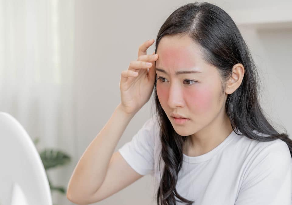woman checking her rosacea in the mirror