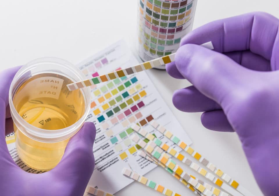 reagent strip using in drug test with test chart