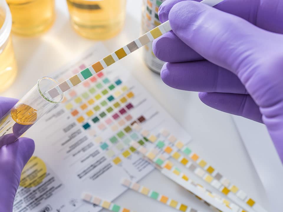 test tires in violet gloves with test chart and urine can